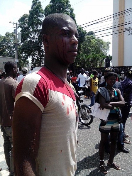 man beaten by dominican pokice for complaining about problems with regularization process